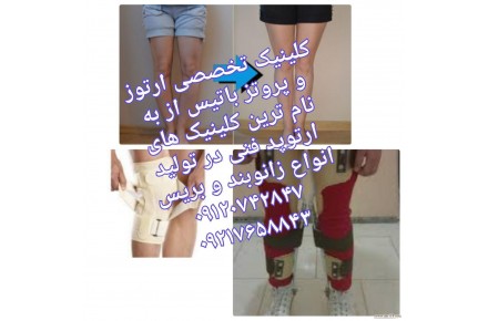 درمان پای پرانتزی در کودکان و بزرگسالان - 3