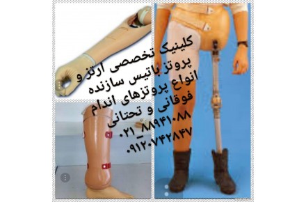 کلینیک تخصصی ارتز و پروتز باتیس - 2