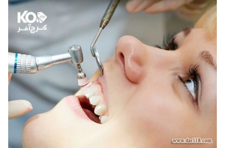 تخصصی ترین مرکز جرمگیری و بروساژ دندان در کلینیک دکتر عزیزی با ۶۶% تخفیف  - 1