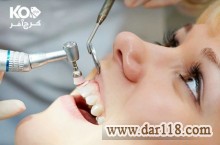 تخصصی ترین مرکز جرمگیری و بروساژ دندان در کلینیک دکتر عزیزی با ۶۶% تخفیف 