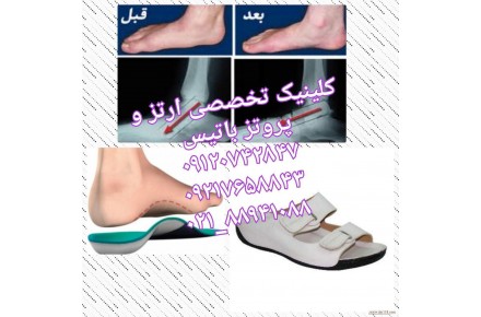 درمان صافی کف پا با استفاده از کفش طبی و کفی طبی - 2