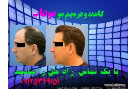 کاشت و ترمیم مو - 1