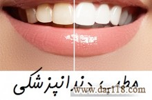 بهترین دندانپزشکی مرکز تهران عصب کشی دندان 