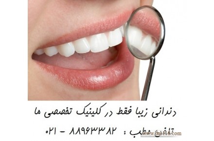 قیمت روکش دندان بهترین متخصص دندانپزشکی زیبایی    - 1