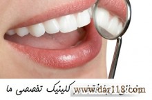 قیمت روکش دندان بهترین متخصص دندانپزشکی زیبایی   