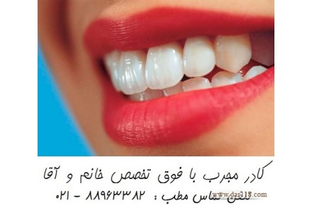 خدمات دندانپزشکی زیبایی سفید کردن دندان طراحی لبخند هالیوودی  - 1