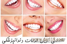 خدمات دندانپزشکی تخصصی معروف ترین کلینیک دندانپزشکی تهران   