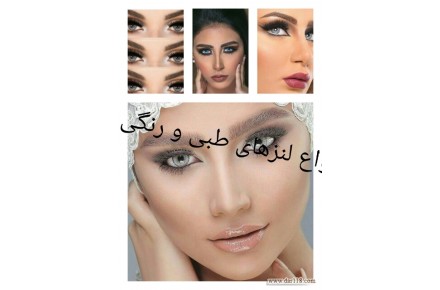 بینایی سنجی و فروش انواع عینک ولنز - 2