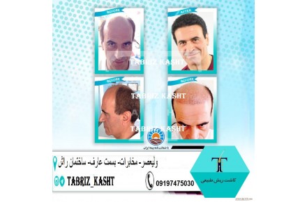 تبریز کاشت - 1