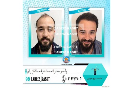 تبریز کاشت - 3