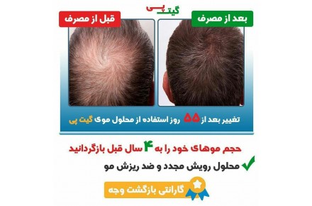 محلول ضد ریزش و رویش مجدد مو گیت پی - 3