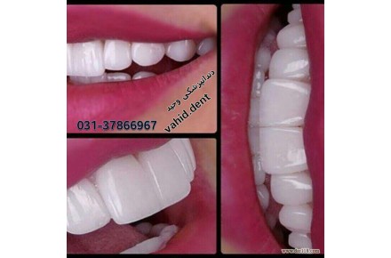 انجام کلیه خدمات دندانپزشکی - 3
