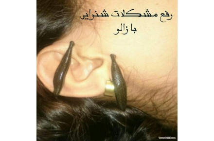 درمان بیماری از راه  چشم، خدمات زالو درمانی و انرژی درمانی  - 2