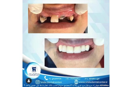  کلینیک دندانپزشکی لبخند،جراحی ایمپلنت پیشرفته،درمان ریشه،ترمیم دندان و ... - 1
