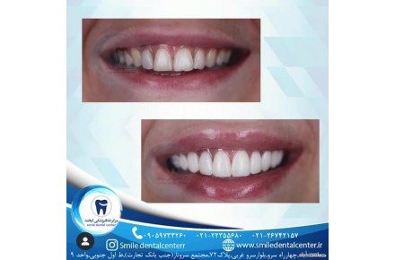  کلینیک دندانپزشکی لبخند،جراحی ایمپلنت پیشرفته،درمان ریشه،ترمیم دندان و ... - 2