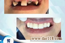 کلینیک دندانپزشکی لبخند،جراحی ایمپلنت پیشرفته،درمان ریشه،ترمیم دندان و ...