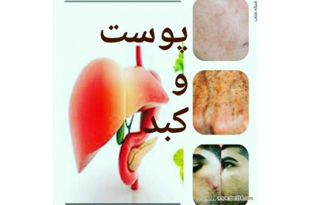 فروش انواع دمنوش لاغری افزایش اشتها پاکسازی کبد پاکسازی پوست کنترل دیابت و... - 1
