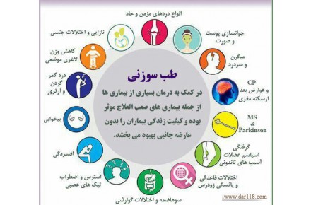 طب سوزنی توسط پزشک متخصص - 2