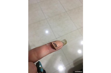  شنوايي سنجي - 3