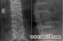 رادیولوژی و سونوگرافی در منزل(پرتابل) امید