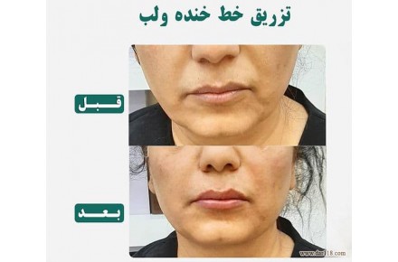 دکتر مهشید طالبی متخصص پوست و مو - 2