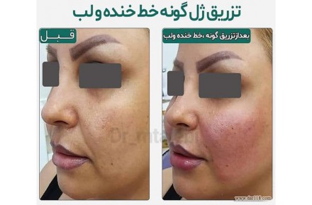 دکتر مهشید طالبی متخصص پوست و مو - 3