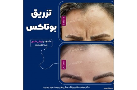 مرکزپوست ولیزروزیبایی دکترمهشیدطالبی - 1
