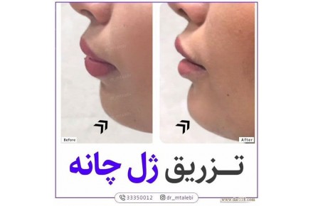 مرکزپوست ولیزروزیبایی دکترمهشیدطالبی - 2