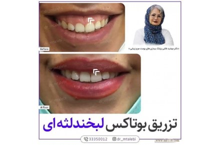 مرکزپوست ولیزروزیبایی دکترمهشیدطالبی - 3