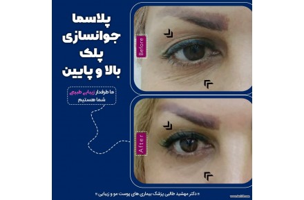 مرکزپوست ولیزرشادن- دکترمهشیدطالبی