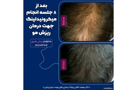 مرکزپوست ولیزرشادن- دکترمهشیدطالبی - 2