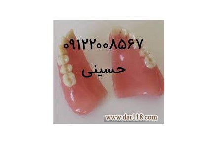 تعمیر دندان مصنوعی شکسته - 3