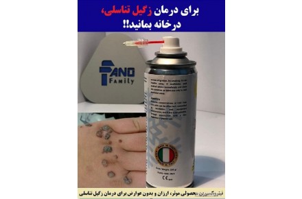 درمان خانگی زگیل تناسلی (فروش اسپری کرایوتراپی) - 1
