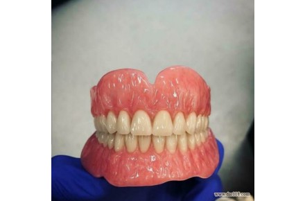 ساخت انواع دندان مصنوعی - تصویر شماره 1
