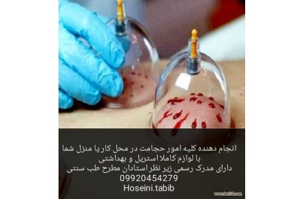 حجامت و بادکش تخصص ماست