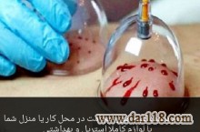 حجامت و بادکش تخصص ماست