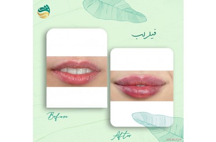 کلینیک زیبایی و لیزر دادمان - 2