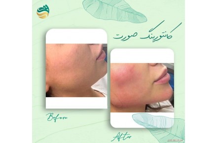 کلینیک زیبایی و لیزر دادمان - 3