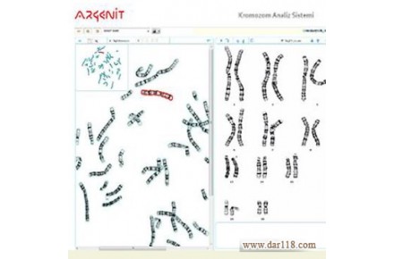 فروش نرم افزار کاریوتایپ تمام اتوماتیک پیشرفته