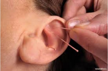 آموزش تخصصی طب سوزنی و طب فشاری - 2