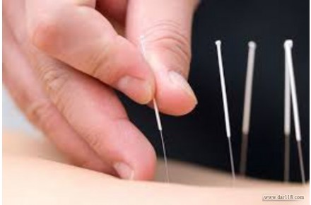 آموزش تخصصی طب سوزنی و طب فشاری - 3