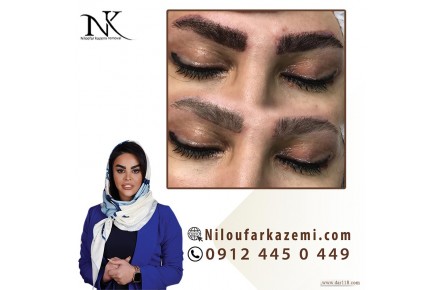 نیلوفر کاظمی ریمووکار حرفه ای - 2