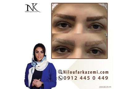 ریموو تاتو ابرو با روش های عالی - 2