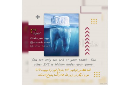 طراحی گرافیک، موشن گرافیک، انیمیشن، تیزر - 1