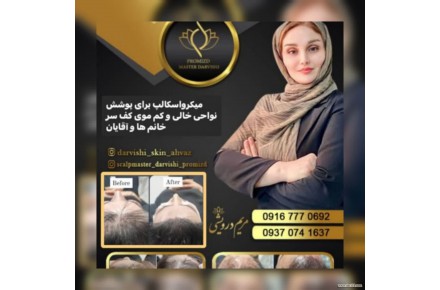 میکرواسکالپ سر - 1