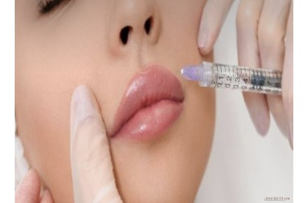 مدل ژل و بوتاکس توسط پزشک - 3