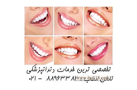 بهترین دندانپزشک در تهران معروف ترین متخصص لمینیت در تهران  - 1
